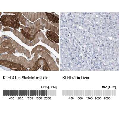 <b>Orthogonal Strategies Validation. </b>Immunohistochemistry-Paraffin: KBTBD10 Antibody [NBP1-80788] - Staining in human skeletal muscle and liver tissues using anti-KLHL41 antibody. Corresponding KLHL41 RNA-seq data are presented for the same tissues.