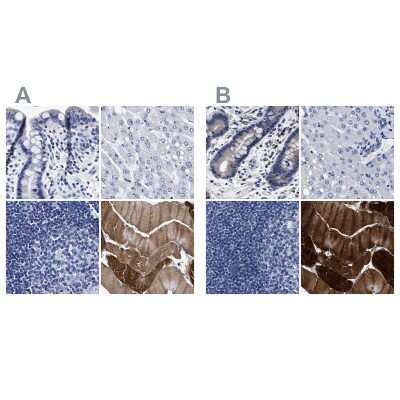 <b>Independent Antibodies Validation. </b>Immunohistochemistry-Paraffin: KBTBD10 Antibody [NBP1-80788] - Staining of human colon, liver, lymph node and skeletal muscle using Anti-KLHL41 antibody NBP1-80788 (A) shows similar protein distribution across tissues to independent antibody NBP1-80787 (B).