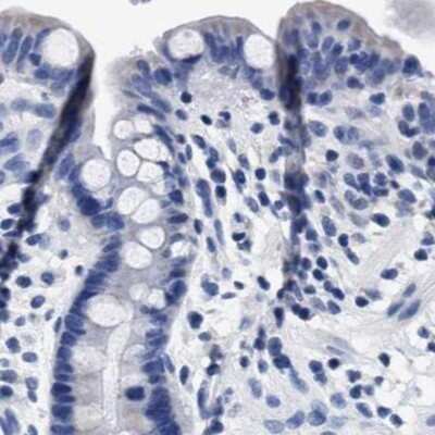 Immunohistochemistry-Paraffin: KBTBD10 Antibody [NBP1-80788] - Staining of human colon.