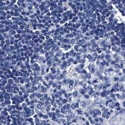 Immunohistochemistry-Paraffin: KBTBD10 Antibody [NBP1-80788] - Staining of human lymph node.