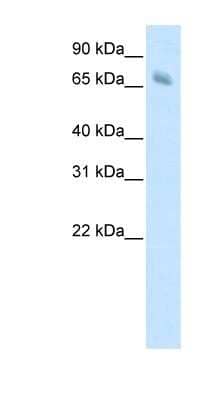 Western Blot: KBTBD10 Antibody [NBP1-80310] - Human Muscle lysate, concentration 1.25ug/ml.