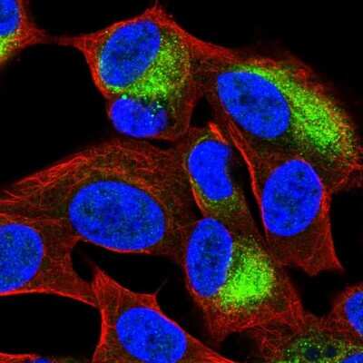 Immunocytochemistry/Immunofluorescence: KBTBD11 Antibody [NBP2-14728] - Staining of human cell line SH-SY5Y shows localization to intermediate filaments.