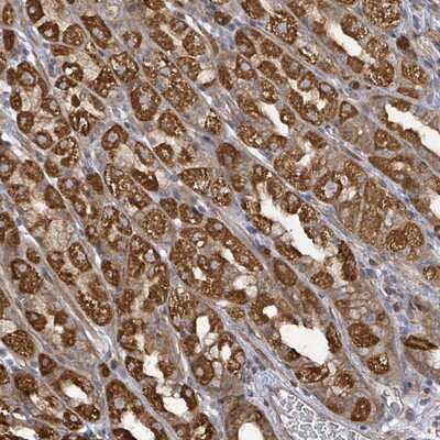 Immunohistochemistry-Paraffin: KBTBD11 Antibody [NBP2-14728] - Staining of human stomach, lower shows strong cytoplasmic positivity in glandular cells.