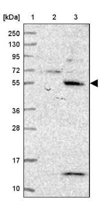 Western Blot: KBTBD11 Antibody [NBP2-14728] - Lane 1: Marker  [kDa] 250, 130, 95, 72, 55, 36, 28, 17, 10.  Lane 2: Human cell line RT-4.  Lane 3: Human cell line U-251MG sp