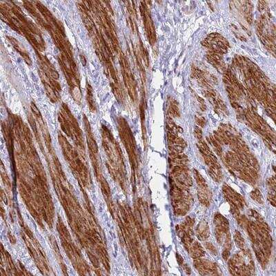Immunohistochemistry-Paraffin: KBTBD3 Antibody [NBP2-14592] - Staining of human smooth muscle shows strong cytoplasmic positivity in smooth muscle cells.