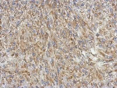Immunohistochemistry-Paraffin: KBTBD3 Antibody [NBP2-17022] - Immunohistochemical analysis of paraffin-embedded U87 xenograft, using antibody at 1:500 dilution.