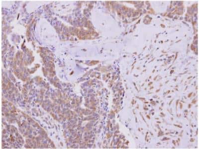 Immunohistochemistry-Paraffin KBTBD3 Antibody