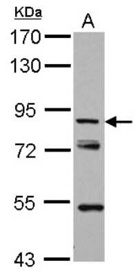Western Blot: KBTBD3 Antibody [NBP2-17022] - Sample (30 ug of whole cell lysate) A: PC-3 7. 5% SDS PAGE gel, diluted at 1:2000.
