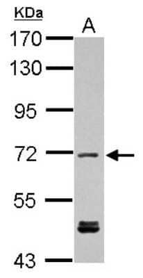Western Blot KBTBD3 Antibody