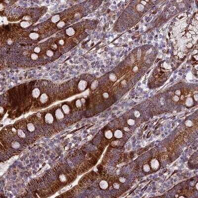 Immunohistochemistry-Paraffin: KBTBD7 Antibody [NBP1-92040] - Staining of human duodenum shows strong cytoplasmic positivity in glandular cells.