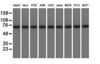 Western Blot: KBTBD7 Antibody (OTI1G3) - Azide and BSA Free [NBP2-72268] - Analysis of extracts (35ug) from 9 different cell lines by using anti-KBTBD7 monoclonal antibody.