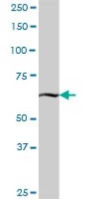 Western Blot: KBTBD7 Antibody [H00084078-B01P] - Analysis of KBTBD7 expression in human placenta.