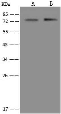 Western Blot: KBTBD7 Antibody [NBP3-12552] - Lane A: HL-60 Whole Cell LysateLane B: A549 Whole Cell LysateLysates/proteins at 30 ug per lane.SecondaryGoat Anti-Rabbit IgG (H+L)/HRP at 1/10000 dilution.Developed using the ECL technique.Performed under reducing conditions.Predicted band size:77 kDaObserved band size:77 kDa