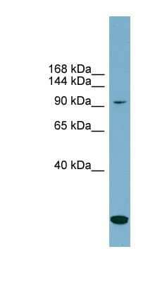 Western Blot: KCC1/SLC12A4 Antibody [NBP1-58293] - PANC1 cell lysate, concentration 0.2-1 ug/ml.