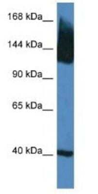 Western Blot: KCC2/SLC12A5 Antibody [NBP1-74063] -  Mouse Brain Lysate 1ug/ml Gel Concentration 6-18%
