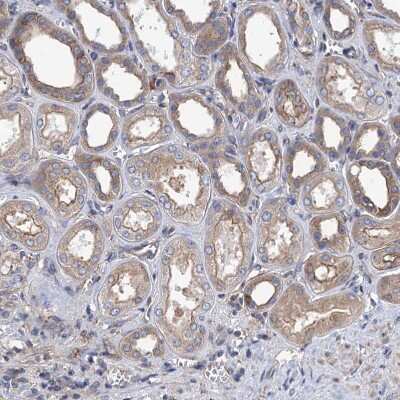 Immunohistochemistry-Paraffin: KCC4/SLC12A7 Antibody [NBP1-85133] - Staining of human kidney shows moderate cytoplasmic positivity in cells in tubules.