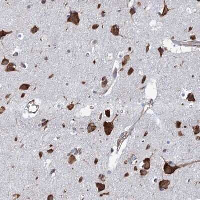 Immunohistochemistry-Paraffin KCC4/SLC12A7 Antibody