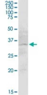 Western Blot KCC4/SLC12A7 Antibody