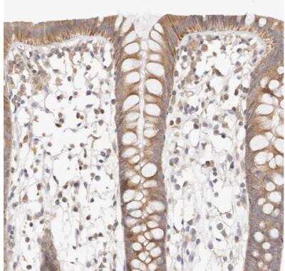 Immunohistochemistry-Paraffin KCMF1 Antibody - BSA Free