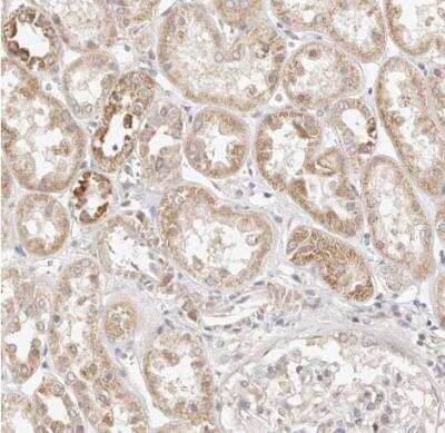 Immunohistochemistry-Paraffin KCMF1 Antibody - BSA Free