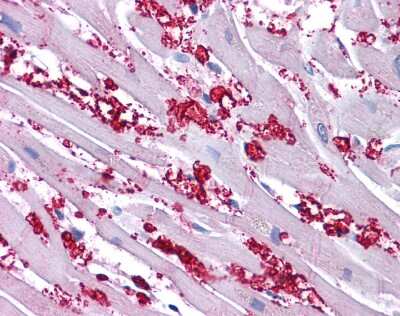 Immunohistochemistry-Paraffin: KCNA10 Antibody [NBP3-10357] - Immunohistochemical analysis of formalin-fixed paraffin-embedded human heart tissue after heat-induced antigen retrieval. Antibody concentration 5 ug/ml.