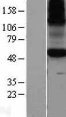 Western Blot: KCNA10 Overexpression Lysate (Adult Normal) [NBL1-12138] Left-Empty vector transfected control cell lysate (HEK293 cell lysate); Right -Over-expression Lysate for KCNA10.