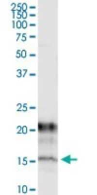 Immunoprecipitation: KCNE1 Antibody (2A6) [H00003753-M13] - Analysis of KCNE1 transfected lysate using anti-KCNE1 monoclonal antibody and Protein A Magnetic Bead, and immunoblotted with KCNE1 rabbit polyclonal antibody.