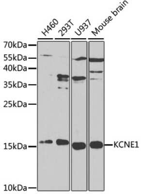 Western Blot: KCNE1 Antibody [NBP3-03910] - Analysis of extracts of various cell lines, using KCNE1 antibody at 1:1000 dilution. Secondary antibody: HRP Goat Anti-Rabbit IgG (H+L) at 1:10000 dilution. Lysates/proteins: 25ug per lane. Blocking buffer: 3% nonfat dry milk in TBST. Detection: ECL Basic Kit