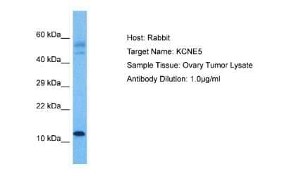 Western Blot: KCNE1-like Antibody [NBP2-83103] - Host: Rabbit. Target Name: KCNE1L. Sample Tissue: Human Ovary Tumor. Antibody Dilution: 1.0ug/ml