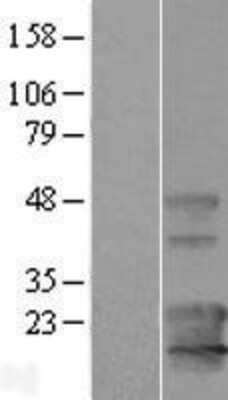 Western Blot: KCNE1L Overexpression Lysate (Adult Normal) [NBL1-12148] Left-Empty vector transfected control cell lysate (HEK293 cell lysate); Right -Over-expression Lysate for KCNE1L.