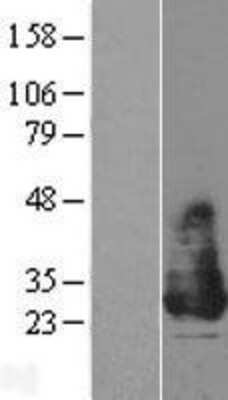 Western Blot: KCNE2 Overexpression Lysate (Adult Normal) [NBL1-12149] Left-Empty vector transfected control cell lysate (HEK293 cell lysate); Right -Over-expression Lysate for KCNE2.