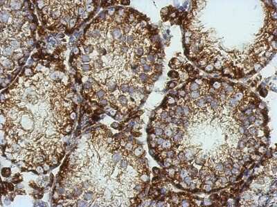 Immunohistochemistry-Paraffin Kv6.4 Antibody