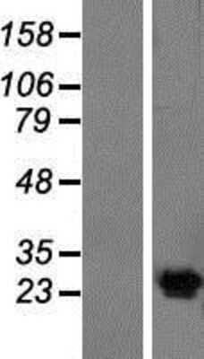 Western Blot: KCNG4 Overexpression Lysate (Adult Normal) [NBP2-09968] Left-Empty vector transfected control cell lysate (HEK293 cell lysate); Right -Over-expression Lysate for KCNG4.