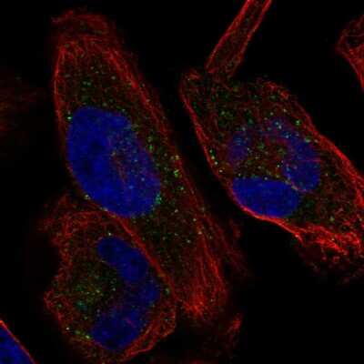 Immunocytochemistry/Immunofluorescence: KCNH1 Antibody [NBP2-58376] - Staining of human cell line RH-30 shows localization to vesicles.