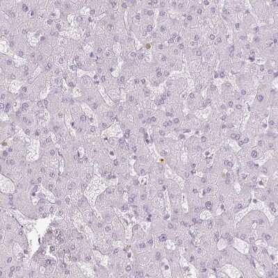 Immunohistochemistry-Paraffin: KCNH1 Antibody [NBP1-84935] - Staining of human liver shows no positivity in hepatocytes, as expected.