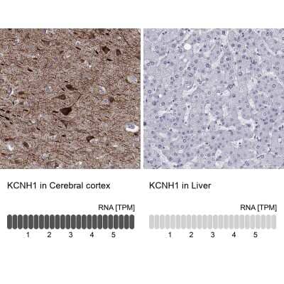 Immunohistochemistry-Paraffin: KCNH1 Antibody [NBP3-17103] - Analysis in human cerebral cortex and liver tissues using Anti-KCNH1 antibody. Corresponding KCNH1 RNA-seq data are presented for the same tissues.