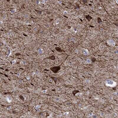 Immunohistochemistry-Paraffin KCNH1 Antibody