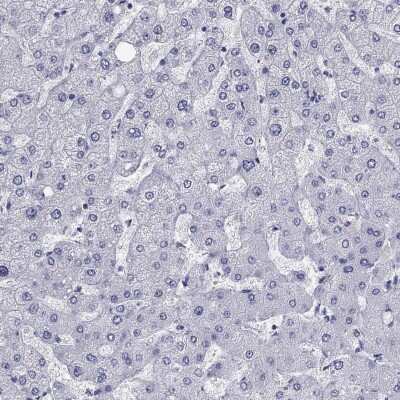 Immunohistochemistry-Paraffin: KCNH1 Antibody [NBP3-17103] - Staining of human liver shows low expression as expected.