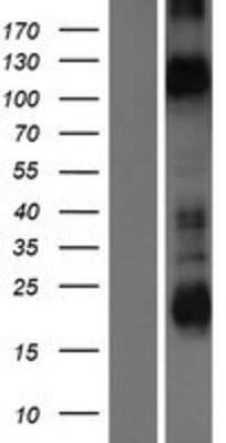 Western Blot: KCNH1 Overexpression Lysate (Adult Normal) [NBP2-09780] Left-Empty vector transfected control cell lysate (HEK293 cell lysate); Right -Over-expression Lysate for KCNH1.