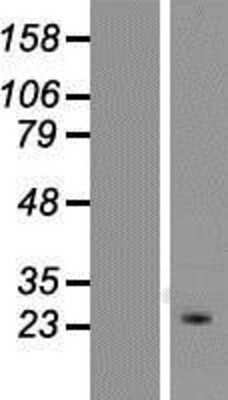 Western Blot: KCNIP4 Overexpression Lysate (Adult Normal) [NBP2-05436] Left-Empty vector transfected control cell lysate (HEK293 cell lysate); Right -Over-expression Lysate for KCNIP4.