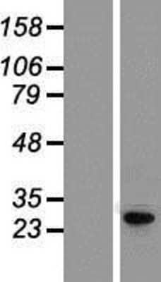Western Blot: KCNIP4 Overexpression Lysate (Adult Normal) [NBP2-06205] Left-Empty vector transfected control cell lysate (HEK293 cell lysate); Right -Over-expression Lysate for KCNIP4.