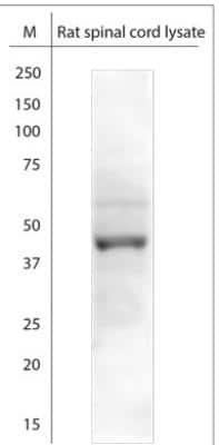 Western Blot KCNJ10 Antibody