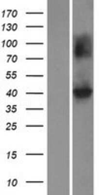 Western Blot KCNJ10 Overexpression Lysate