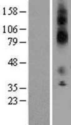 Western Blot: KCNJ13 Overexpression Lysate (Adult Normal) [NBL1-12165] Left-Empty vector transfected control cell lysate (HEK293 cell lysate); Right -Over-expression Lysate for KCNJ13.