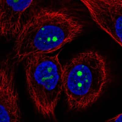 Immunocytochemistry/ Immunofluorescence KCNJ14 Antibody