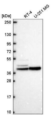 Western Blot KCNJ14 Antibody