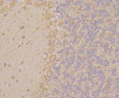 Immunohistochemistry: KCNK1 Antibody [NBP2-76940] - Immunohistochemical analysis of paraffin-embedded rat cerebellum tissue using anti-KCNK1 antibody. Counter stained with hematoxylin.