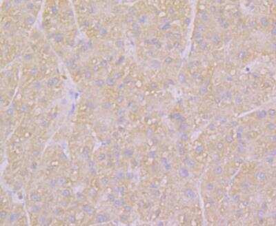 Immunohistochemistry: KCNK1 Antibody [NBP2-76940] - Immunohistochemical analysis of paraffin-embedded human liver tissue using anti-KCNK1 antibody. Counter stained with hematoxylin.
