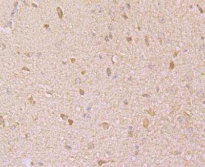 Immunohistochemistry: KCNK1 Antibody [NBP2-76940] - Immunohistochemical analysis of paraffin-embedded mouse brain tissue using anti-KCNK1 antibody. Counter stained with hematoxylin.