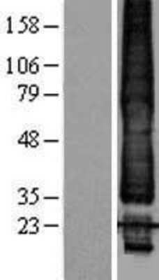 Western Blot: KCNK1 Overexpression Lysate (Adult Normal) [NBL1-12176] Left-Empty vector transfected control cell lysate (HEK293 cell lysate); Right -Over-expression Lysate for KCNK1.